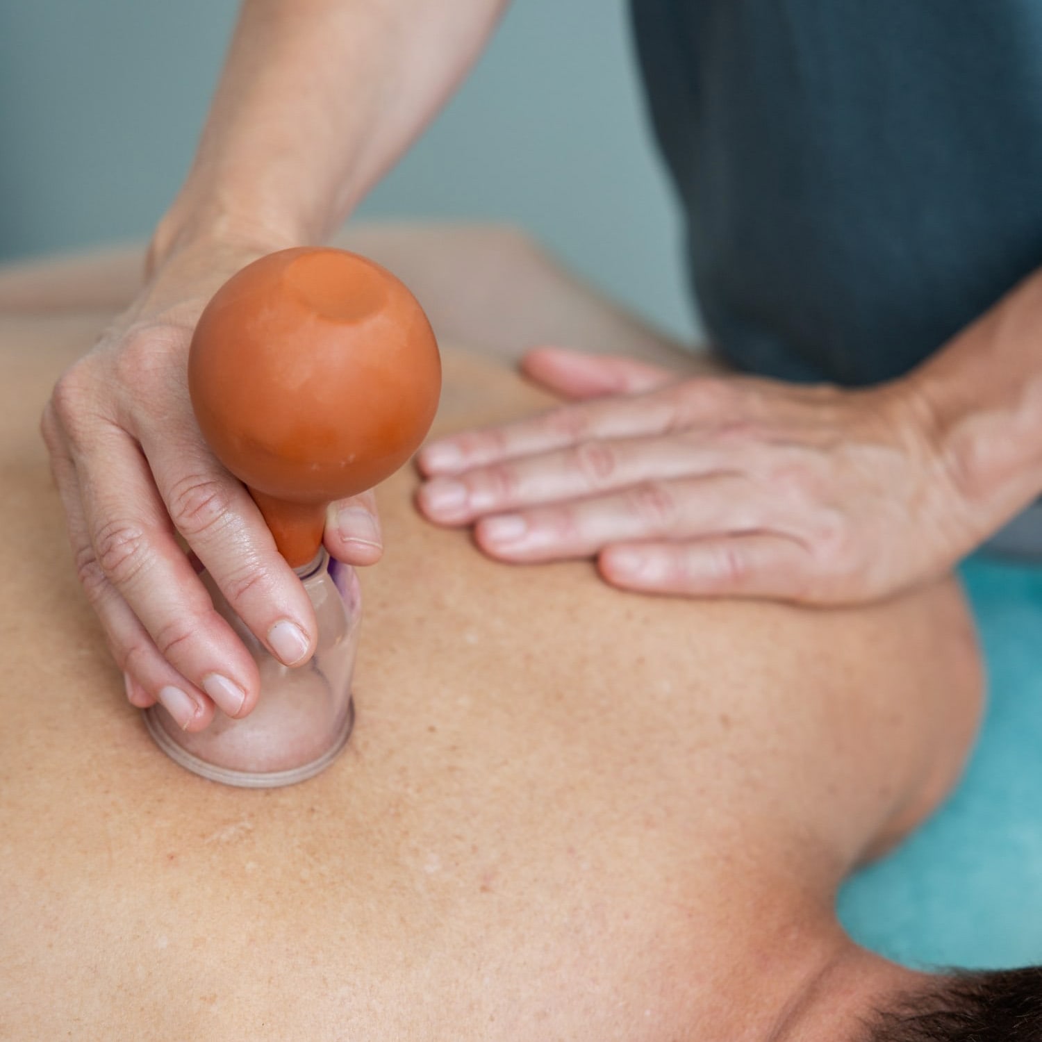 Schröpftherapie in der Naturheilpraxis von Petra Noll